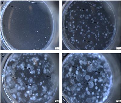 The Promise of Lung Organoids for Growth and Investigation of Pneumocystis Species